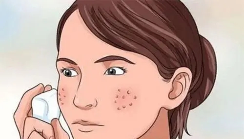 面部毛孔粗大怎么办 去毛孔粗大最有效的方法